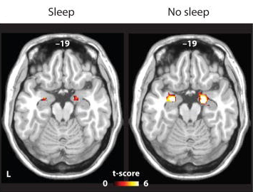 Motnje spanja - vpliv spanja na zdravje